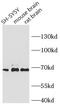Nf68 antibody, FNab05710, FineTest, Western Blot image 