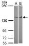 Protein Tyrosine Phosphatase Non-Receptor Type 14 antibody, PA5-28302, Invitrogen Antibodies, Western Blot image 