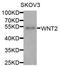 Wnt Family Member 2 antibody, orb178671, Biorbyt, Western Blot image 