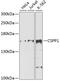 Centrosome and spindle pole-associated protein 1 antibody, GTX65610, GeneTex, Western Blot image 
