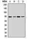 Glucosamine--fructose-6-phosphate aminotransferase [isomerizing] 1 antibody, LS-C667810, Lifespan Biosciences, Western Blot image 