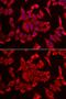SLC20A2 antibody, GTX65819, GeneTex, Immunofluorescence image 