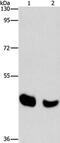 Bile acid-CoA:amino acid N-acyltransferase antibody, PA5-50362, Invitrogen Antibodies, Western Blot image 