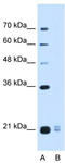Oocyte Secreted Protein 2 antibody, TA342545, Origene, Western Blot image 