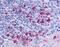 C-C chemokine receptor type 6 antibody, NLS356, Novus Biologicals, Immunohistochemistry paraffin image 