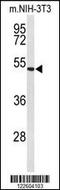 EGF Containing Fibulin Extracellular Matrix Protein 2 antibody, 63-863, ProSci, Western Blot image 