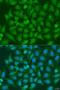 X-Box Binding Protein 1 antibody, LS-C348946, Lifespan Biosciences, Immunofluorescence image 