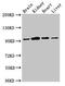 N-alpha-acetyltransferase 15, NatA auxiliary subunit antibody, LS-C672564, Lifespan Biosciences, Western Blot image 
