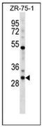 Homeobox D1 antibody, AP52083PU-N, Origene, Western Blot image 