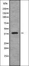 NFAT Activating Protein With ITAM Motif 1 antibody, orb337822, Biorbyt, Western Blot image 