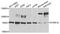 Dual specificity tyrosine-phosphorylation-regulated kinase 1A antibody, orb135415, Biorbyt, Western Blot image 