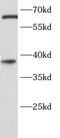 Sprouty RTK Signaling Antagonist 2 antibody, FNab08199, FineTest, Western Blot image 