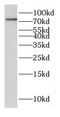 Family With Sequence Similarity 114 Member A1 antibody, FNab02955, FineTest, Western Blot image 