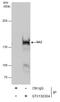 Cohesin subunit SA-2 antibody, GTX130304, GeneTex, Immunoprecipitation image 