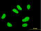 Ubiquitin Conjugating Enzyme E2 E2 antibody, LS-C198395, Lifespan Biosciences, Immunofluorescence image 