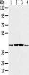 Phosphoribosylaminoimidazole Carboxylase And Phosphoribosylaminoimidazolesuccinocarboxamide Synthase antibody, TA350264, Origene, Western Blot image 