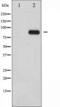 Heat Shock Transcription Factor 1 antibody, TA325541, Origene, Western Blot image 