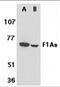 Fem-1 Homolog B antibody, 2279, ProSci, Western Blot image 