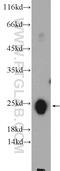 Troponin I2, Fast Skeletal Type antibody, 22130-1-AP, Proteintech Group, Western Blot image 