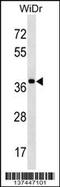 Speckle-type POZ protein antibody, 60-100, ProSci, Western Blot image 
