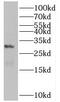 Class A basic helix-loop-helix protein 15 antibody, FNab00886, FineTest, Western Blot image 