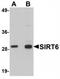 Sirtuin 6 antibody, TA319931, Origene, Western Blot image 