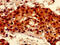 RalA-binding protein 1 antibody, CSB-PA618981LA01HU, Cusabio, Immunohistochemistry paraffin image 