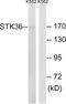 Serine/Threonine Kinase 36 antibody, TA315369, Origene, Western Blot image 