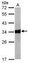 HAD antibody, NBP1-32330, Novus Biologicals, Western Blot image 