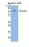 Trefoil Factor 3 antibody, LS-C296803, Lifespan Biosciences, Western Blot image 