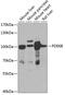 PDE6B antibody, GTX33395, GeneTex, Western Blot image 