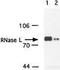 Ribonuclease L antibody, TA309838, Origene, Western Blot image 