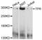Nucleoprotein TPR antibody, A11835, ABclonal Technology, Western Blot image 
