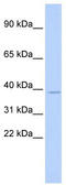 Ts Translation Elongation Factor, Mitochondrial antibody, TA329293, Origene, Western Blot image 