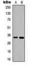 HSJ1 antibody, LS-C354343, Lifespan Biosciences, Western Blot image 