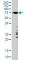 A-Raf Proto-Oncogene, Serine/Threonine Kinase antibody, MCA3988Z, Bio-Rad (formerly AbD Serotec) , Western Blot image 