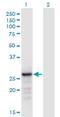 Acidic Nuclear Phosphoprotein 32 Family Member B antibody, H00010541-M05, Novus Biologicals, Western Blot image 