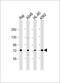 Ski oncogene antibody, M01062, Boster Biological Technology, Western Blot image 