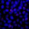 5-azacytidine-induced protein 1 antibody, NB100-68225, Novus Biologicals, Immunocytochemistry image 