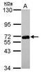 Zinc Finger Protein 587 antibody, GTX119668, GeneTex, Western Blot image 