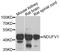NADH:Ubiquinone Oxidoreductase Core Subunit V1 antibody, A13333, ABclonal Technology, Western Blot image 