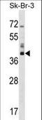 Hydroxysteroid 17-Beta Dehydrogenase 1 antibody, LS-C165031, Lifespan Biosciences, Western Blot image 