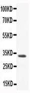 C-C motif chemokine 3 antibody, PB9022, Boster Biological Technology, Western Blot image 