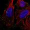 Metavinculin antibody, HPA063777, Atlas Antibodies, Immunofluorescence image 