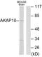 A-Kinase Anchoring Protein 10 antibody, LS-C118683, Lifespan Biosciences, Western Blot image 