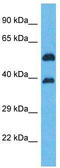 Olfactory Receptor Family 5 Subfamily K Member 2 antibody, TA337530, Origene, Western Blot image 