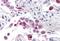 EF-Hand Domain Family Member D1 antibody, NBP1-71995, Novus Biologicals, Immunohistochemistry paraffin image 