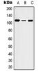 Serine/Threonine Kinase 31 antibody, LS-C353846, Lifespan Biosciences, Western Blot image 
