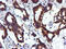 NADH:Ubiquinone Oxidoreductase Subunit B9 antibody, LS-C172622, Lifespan Biosciences, Immunohistochemistry paraffin image 