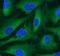 Histone-arginine methyltransferase CARM1 antibody, FNab01275, FineTest, Immunofluorescence image 